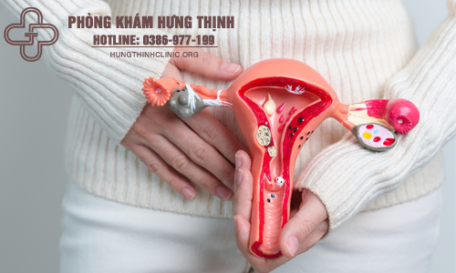 Tư vấn khám sàng lọc ung thư cổ tử cung có đau không?