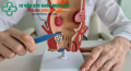Bác sĩ ngoại tổng quát kể lại: ca trĩ độ 4 chảy máu nặng nhưng không cần phẫu thuật