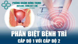 Làm sao để phân biệt bệnh trĩ cấp độ 1 với cấp độ 2