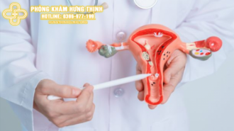 Bị nhân xơ tử cung kiêng ăn gì tốt cho sức khỏe