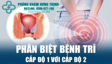 Làm sao để phân biệt bệnh trĩ cấp độ 1 với cấp độ 2